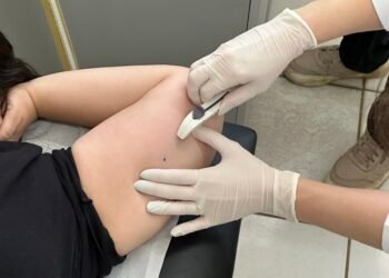 Prefeitura de Americana, vai promover um novo mutirão gratuito de inserção de Implanon, método contraceptivo de alta eficácia e longa duração disponível na rede municipal.